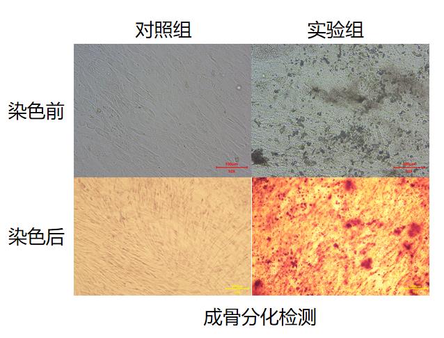 成骨分化檢測